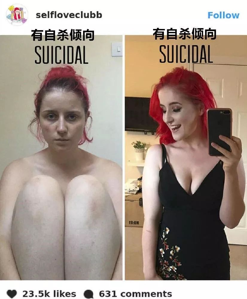 她們都因抑郁癥而死，我希望你開心地活下去