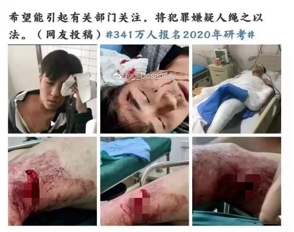 沈陽研究生砍人事件：這三件事，一定要讓孩子知道