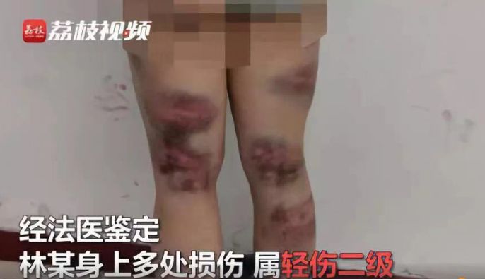 大齡未婚女青年會被歧視嗎？