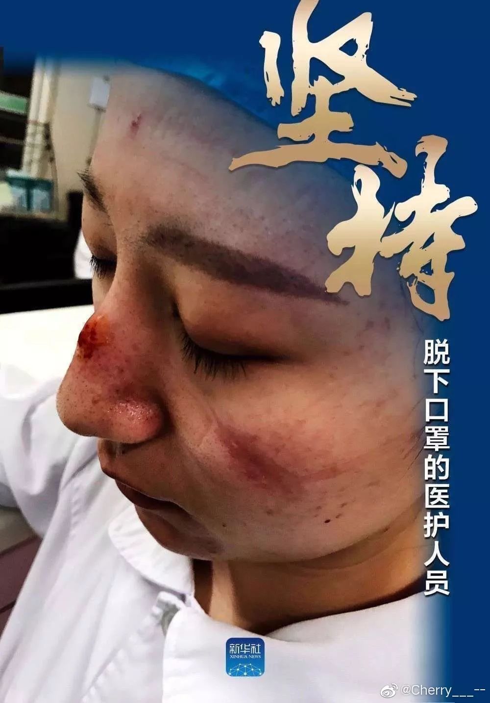 確診老人隱瞞致百余人密切接觸：比病毒更可怕的，是人心