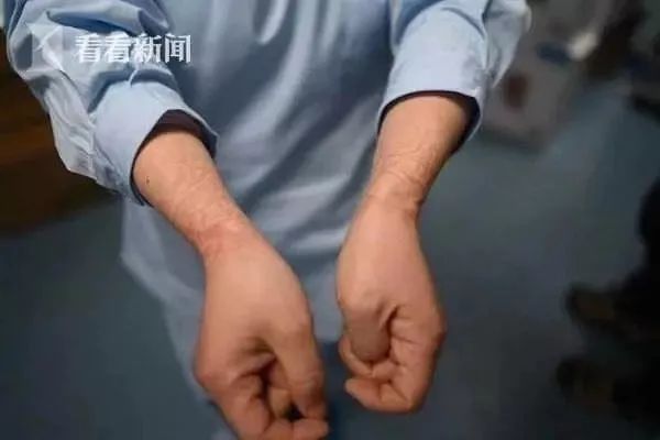 確診老人隱瞞致百余人密切接觸：比病毒更可怕的，是人心
