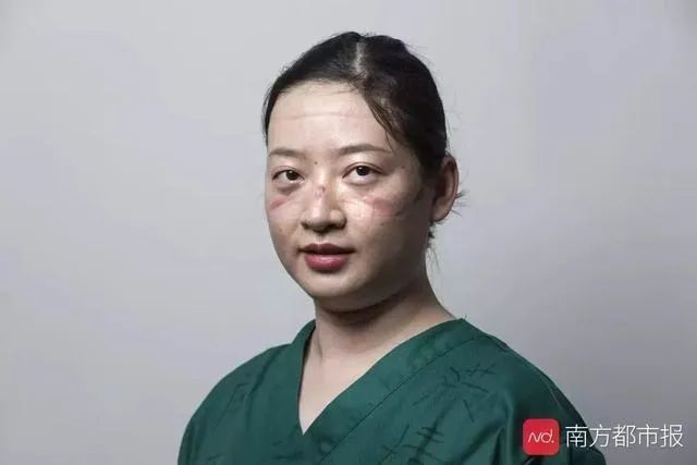 痛哭、失眠、崩潰：疫情過后，他們是最痛苦的人