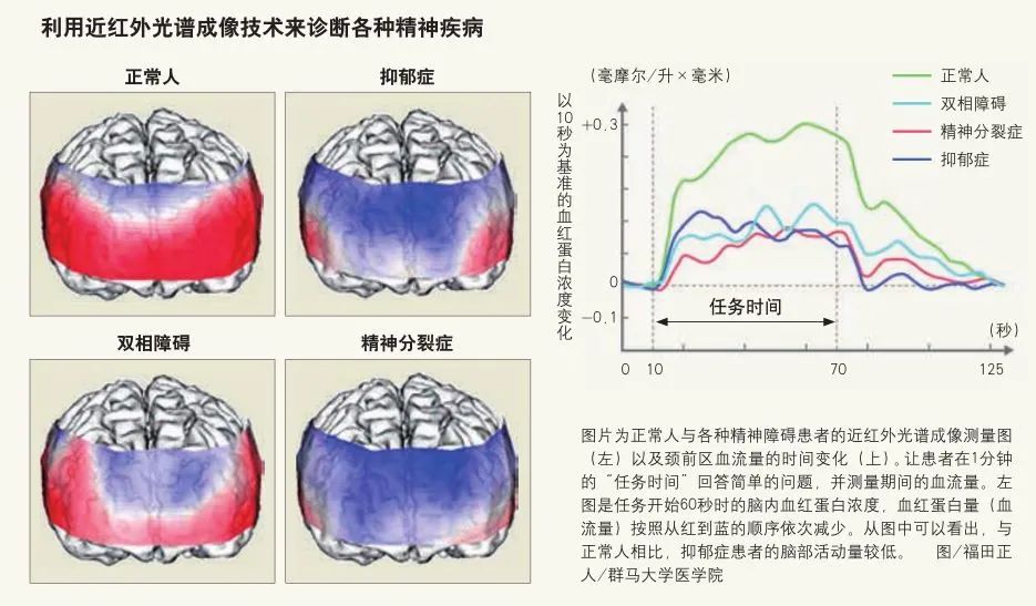 長(zhǎng)期心情低落，我是不是抑郁癥了？