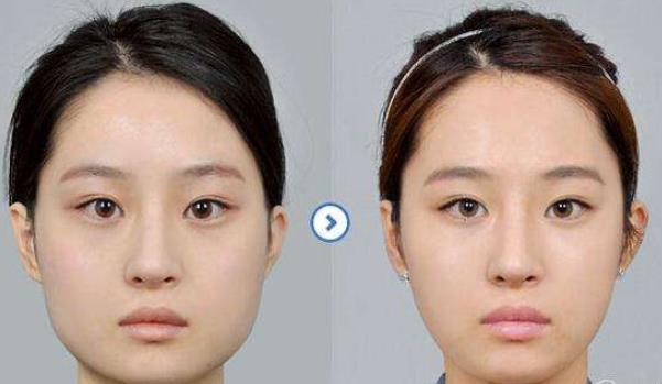 你對整容怎么看？做女人整好？