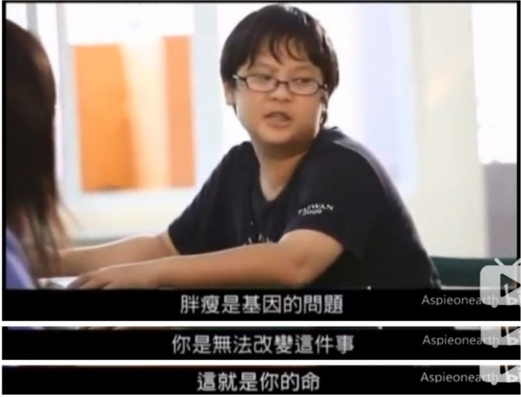 不合群的天才病、阿斯伯格癥