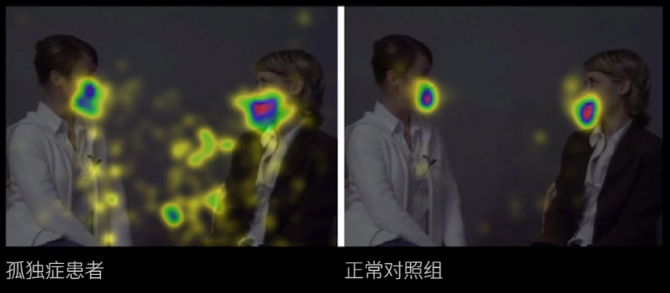 眼動地形圖、早期鑒別孤獨癥孩子的重大發(fā)現(xiàn)
