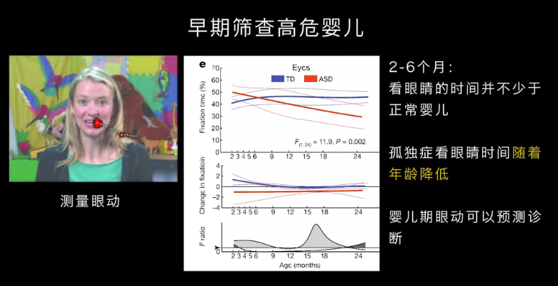 眼動地形圖、早期鑒別孤獨癥孩子的重大發(fā)現(xiàn)