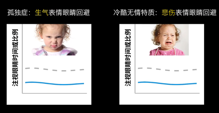 眼動地形圖、早期鑒別孤獨癥孩子的重大發(fā)現(xiàn)